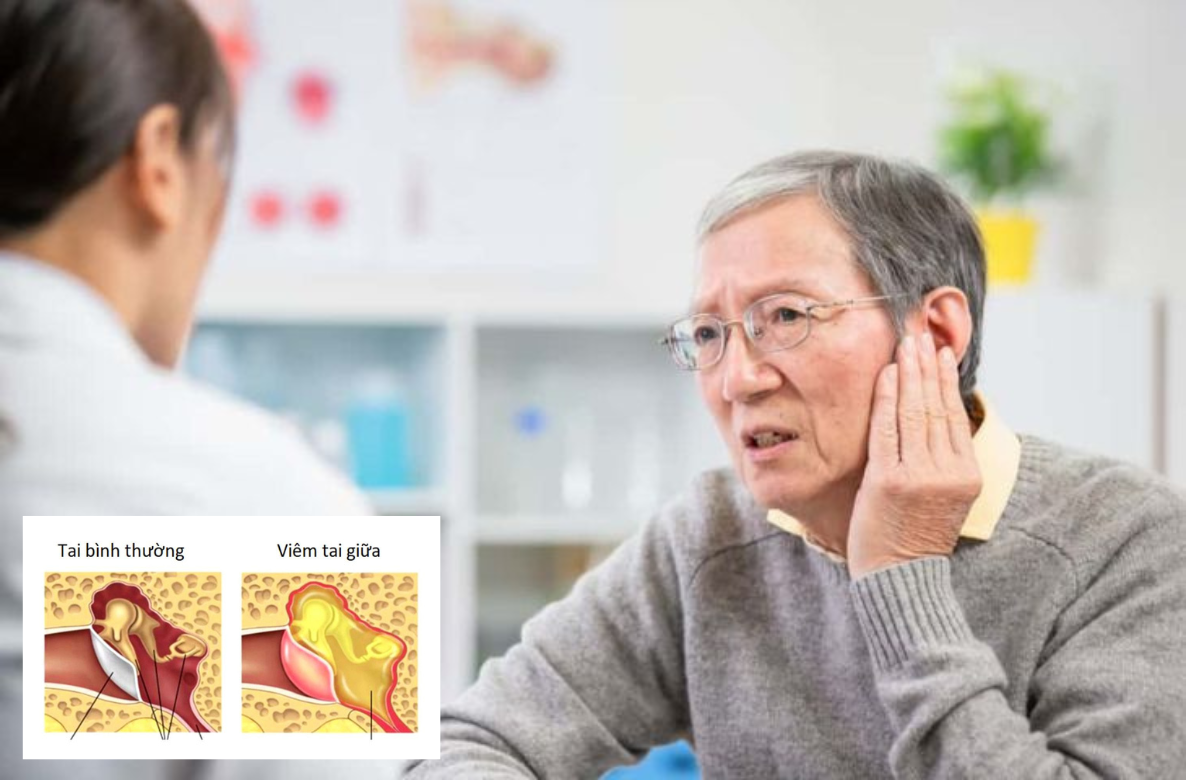 Bệnh về tai gây giảm thính lực